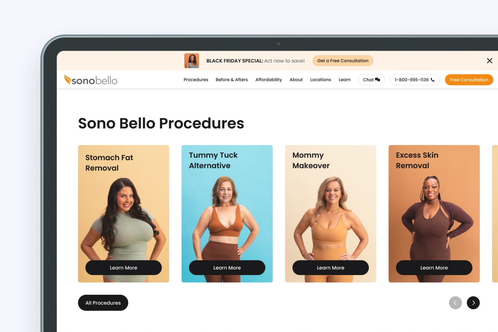 Sono Bello Gallery 1